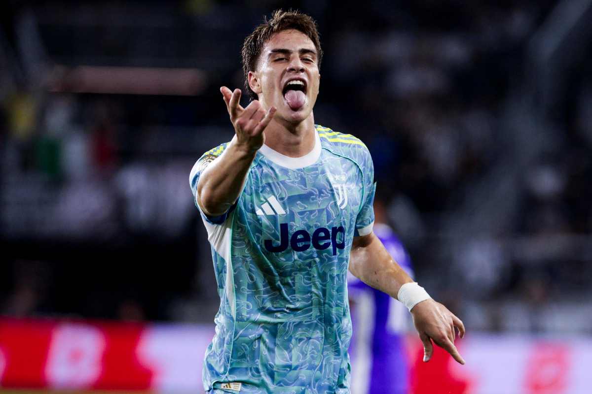 Yildiz Manchester United